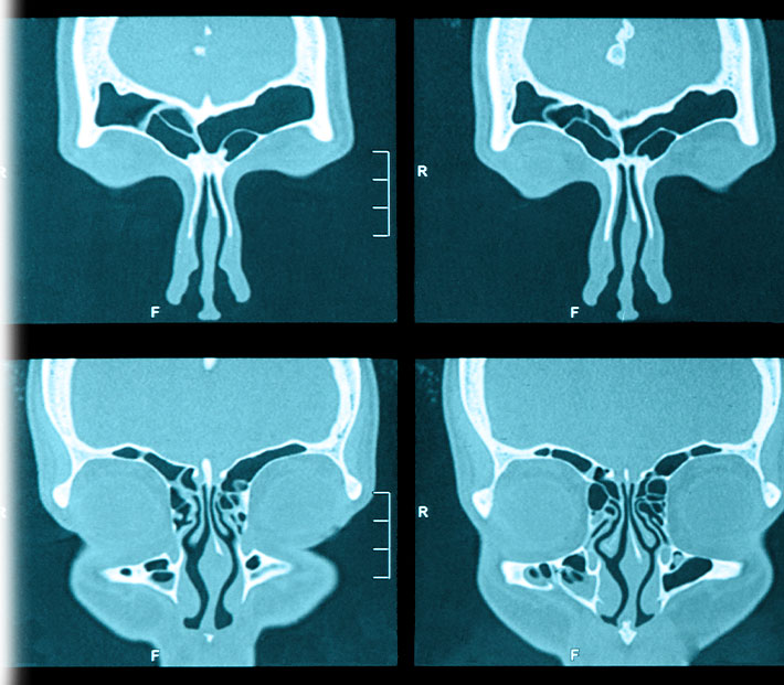 CT Scan Near Me - Family Allergy & Asthma Clinic Denton, Flower Mound