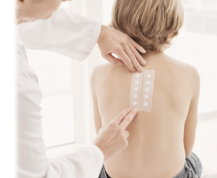 Allergy Patch Test - Family Allergy & Asthma Clinic Denton, Flower Mound